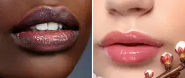 Remedies to Get Rid of Dark Lips